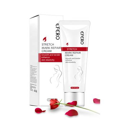 China EFERO Acne Treatment Remove Pregnancy Marks Repair Cream AntiWinkles Anti Aging Acne Cream Stretch Marks Treatment Firming Body Cream for sale