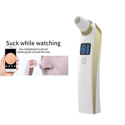 China Black Head Removal Blackhead Remover Vacuum Removing Blackhead Instrument for sale