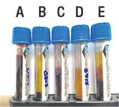 Κίνα Lavender μπλε τοπ , Oxalate νατρίου σωλήνας εμποδίων πηκτωμάτων προς πώληση