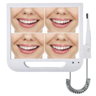 China New Product Metal In China Endoscope Camera Computer System Intraoral Camera Scanner 6 White Led Lights for sale