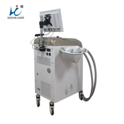 China White Diode Laser Hair Removal Machine , Vavuum Laser Lightsheer Duet Machine for sale