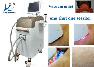 China Fast Vacuum Laser Hair Removal Machine Comfortable Permanent Hair Reduction for sale