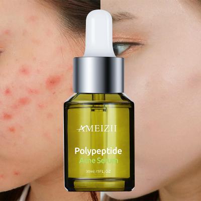 China OEM Factory Herbal Anti-Puffiness Pimple Facial Serum Anti-Puffiness Antibacterial Facial Serum Essence Skin Repairing Polypeptide Serum for sale