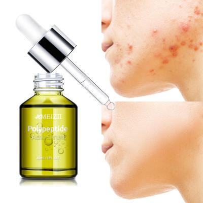 China Wholesale 30Ml Facial Skin Care Serums Lysine Polypeptide Anti Puffiness Whitening Moisturizing Pimples Dark Spot Remover Anti Acne Serum Cream for sale