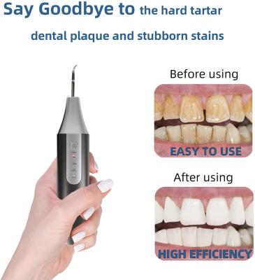 Cina Macchina fotografica dentaria ultrasonica elettrica di Sonic Oral Care Product With Wifi del pulitore in vendita