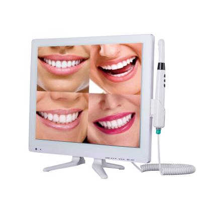 China Hd AliGan Dental Equipment Medical Model New 17 USB High Resolution Endoscope 1280*1024 inch screen 1280*1024 pixel wifi intraoral camera AGB001 for sale