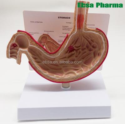 China PVC Advanced Medical Supplies Human Teaching Stomach Anatomical Model For Medical School for sale