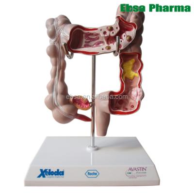 China PVC Advanced Human Teaching Supplies Large Intestine Anatomy Model For School for sale