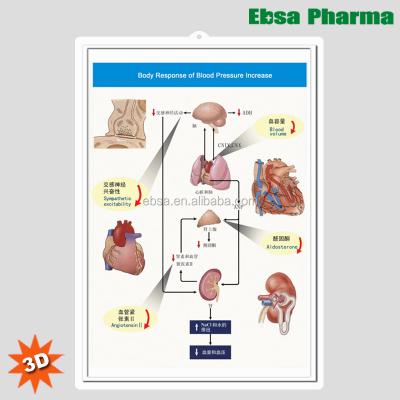 China PVC 3D Medical Human Anatomy Wall Charts / Blood Pressure Decrease Poster-Body Answer for sale