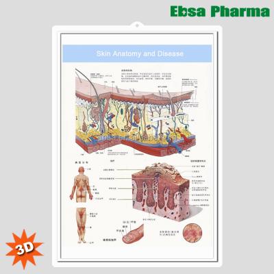 China PVC 3D Medical Human Anatomy Wall Charts / Posters-Skin Anatomy And Disease for sale