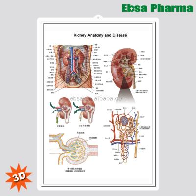 China PVC 3D Medical Human Anatomy Wall Charts / Poster - Kidney Anatomy and Disease for sale