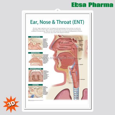 China PVC 3D Medical Human Anatomy Wall Charts / Poster - Ear, Nose & Throat (ENT) for sale