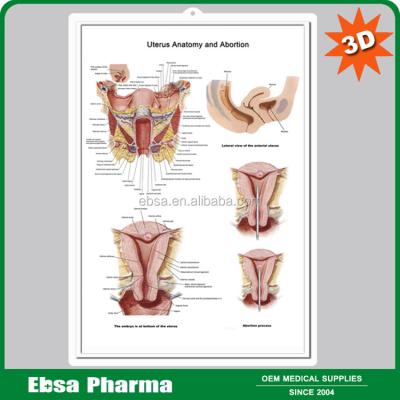 China PVC 3D Medical Human Anatomy Wall Charts / Poster - Uterus Anatomy and Abortion for sale