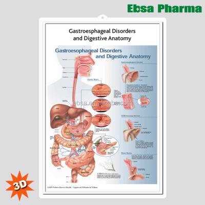 China PVC 3D Medical Human Anatomy Wall Charts / Poster - Gastroesophageal Disorders & Digestive Anatomy for sale