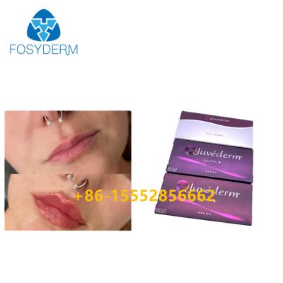 China Juvederm Injectable Dermal Filler 2ml Hyaluronic Acid for sale