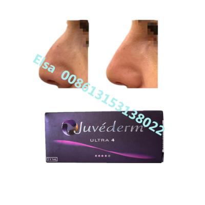 China Juvederm Sodium Ultra4 Voluma Dermal Filler For Lip Chin Augmentation for sale