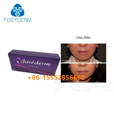 Κίνα Hyaluronic όξινο του προσώπου υλικό πληρώσεως Juvederm Ultra4 δερμικό 2ml αύξησης πηγουνιών προς πώληση