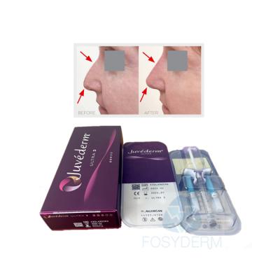 中国 Face Lip Crosslinked Dermal Filler Juvederm Ultra3 Hyaluronic Acid Gel 販売のため