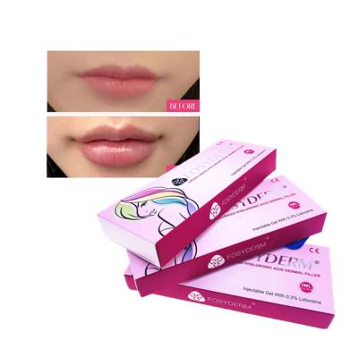 China HA Injectable Dermal Filler Fullness Lip Filler Injections Anti Aging en venta