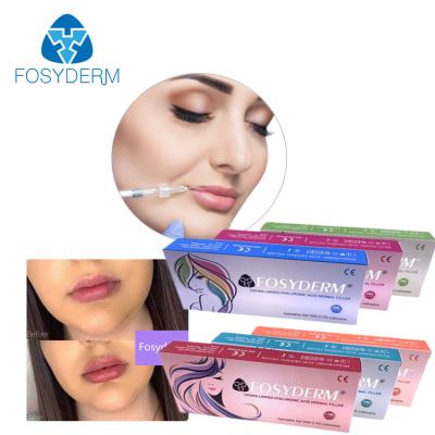 China Dermal Lyft Filler Hyaluronic Acid Dermal Filler 1ml For Lip Enhancement zu verkaufen