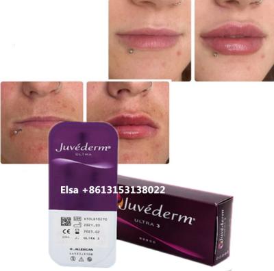 China Cosméticos Cuidados da Pele Injecções Plumper de Lábios Juvederm Filler Injeção Para Nariz Chin Lip à venda