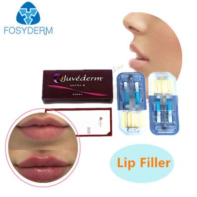 China 2 ml huidvuller met hyaluronzuur JUVEDERM Injecteerbare gelrimpvuller Te koop