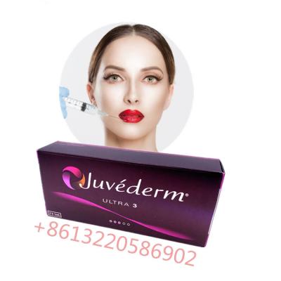 China Het kruis verbond Huid Hyaluronic de Injectieszuur van Juvederm Ultra3 van de Lippenvuller Te koop