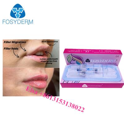 China Lip Cheek And Nasolabial Dermal Filler Hyaluronic acid Ha Injections 1ml 2ml 5ml for sale