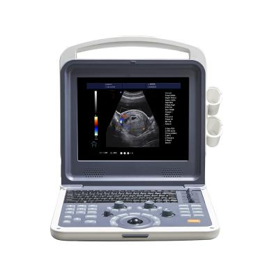 China LTUB01 Other DICOM Full Digital Abdominal Portable Color Doppler Ultrasound Machine for sale