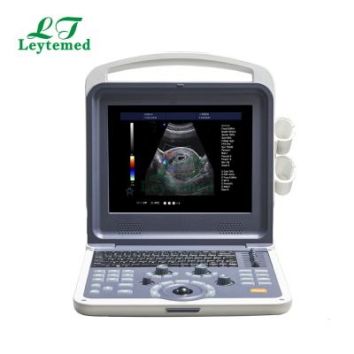 China Other LTUB01 China Factory Portable Laptop Color 4d Doppler Ultrasound for sale