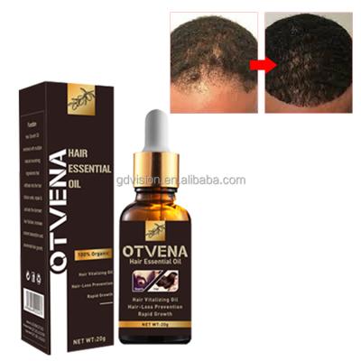 China Best Selling Men Or Women In Africa 30 Days Men Anti Hair Loss OTVENA Hair Growth Oil for sale