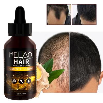 China Hair-Repairing Natural Biotin Quickly Grow Drops Anti Hair Loss Unisex Private Label Argan Oil Strengthening Repair Hair Growth Oil Serum for sale