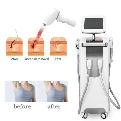 China Pigment removal 808 ND yag laser hair removal and tattoo removal machine with factory pricee for sale