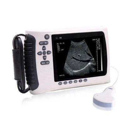 China Portable Abdomen CE ISO Certificate Ultrasound Scanner Machine for sale