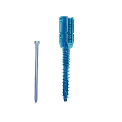 China High Quality Usmart 5.5 Orthopedic Surgery System, Expandable Reduction Pedicle Screw for Osteoporosis Treatment for sale