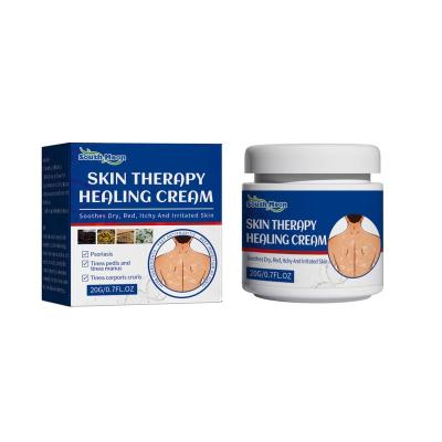 China Moisturizer SOUTH MOON Anti-Dandruff and Anti Pruritic Amino Acid Skin Repair Treatment Skin Therapy Healing Cream For Red Dry Itchy Skin for sale