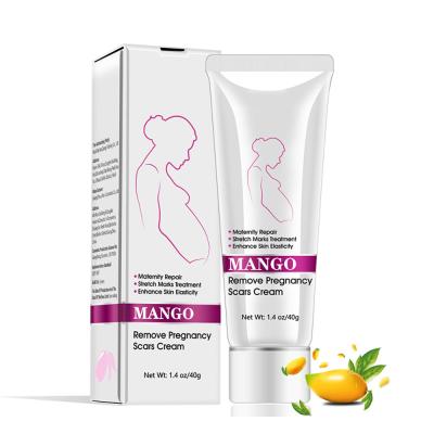 China Skin Revitalizer 2021 Hot Sale Remove Pregnancy Scar Mango Stretch Mark Removal Cream for sale