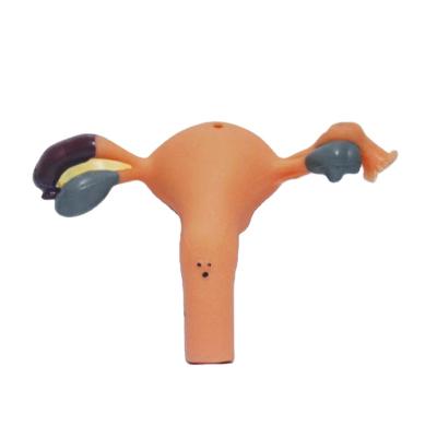 China PVC Quality Assurance 20cm Human Uterine Lesions Model In Reproductive Department for sale