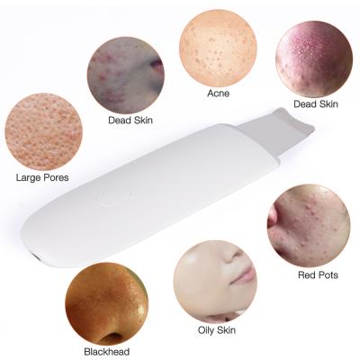 China DEEP CLEANSING Ultrasonic Skin Scrubber Powered Devices Face Scrubber Remover Blackhead Remover Peeling Extractor Facial Cleansing Skin Care for sale