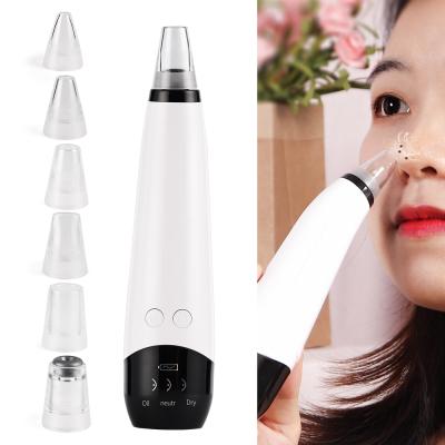 China Other Pore Remover Acne Removal Blackhead Vacuum Blackhead Remover Vacuum Blackhead Remover for sale