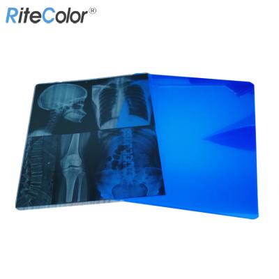 China Used For Radiology Medical Graphics Produce 215micron 8 x 10 Inch X-Ray PET Dry Blue Inkjet Medical Film for sale