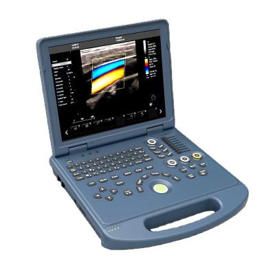 China Metal Factory Price Hospital Laptop Basic Level Medical Color Doppler Ultrasound Machine With CE ISO13485 for sale