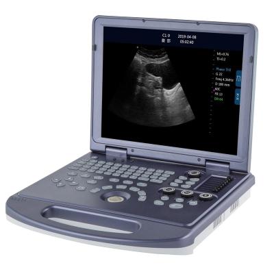 China Full Metal High Quality Laptop Digital B/W 2D Ultrasound Machine With CE ISO13485 for sale