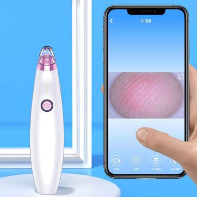 China Acne Treatment Wholesale Bestselling Vacuum Pimples Acne Remover Facial Cleansing Kit Skin Pore Cleansing Kit Blackhead Electric Blackhead Removal Machine OEM ABS for sale