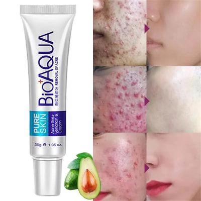 China 30g Skin Acne Removal Essential Cream BIOAQUA Hydrate Oil Control Anti-acne Treatment Cream Face Cream Pure Acne Anti Aging Cream for sale