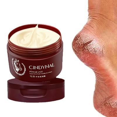 China Natural Organic Moisturzing Foot Repair Anti Fungal Foot Cream Dead Skin Removal Peeling Moisturizing Exfoliation Foot Care Repair Cream For Cracked Heels for sale