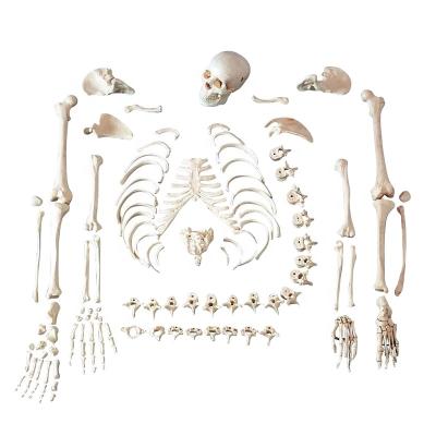 China PVC Disarticulated Advanced Normal Human Skeleton With Skull PNT-0100 for sale