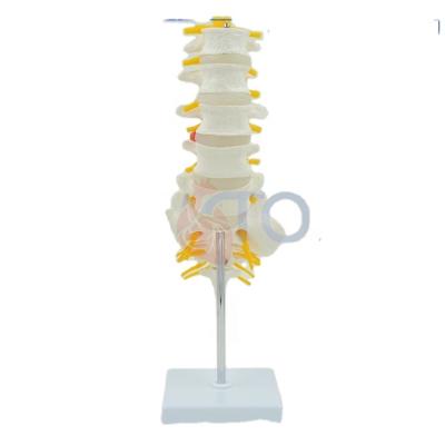 China PVC Advanced Lumbar Vertebra , Sacrum Bones With Spinal Nerves Model for sale