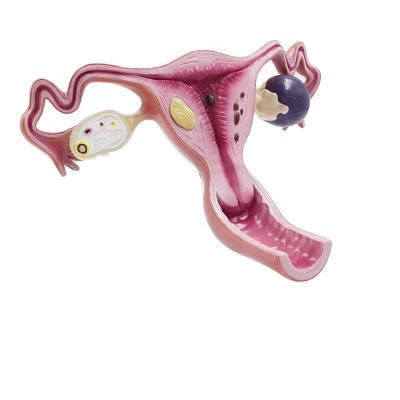 China Uterus Anatomical Artificial Female Organ Demonstration Anatomical Model for sale