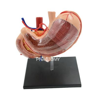 China Digestive System Removable Human Organs Educational Equipment Medical Science Promotion Gift 4D Stomach Medical Detachable Model Anatomical Model for sale